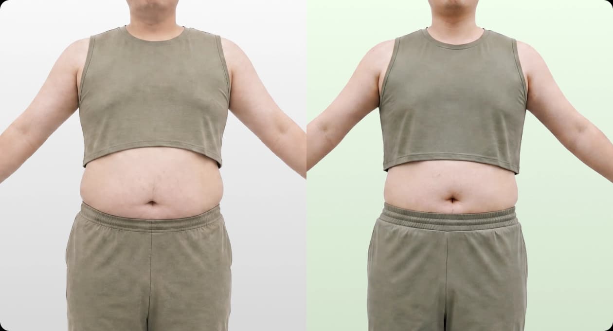 박** BEFORE · AFTER